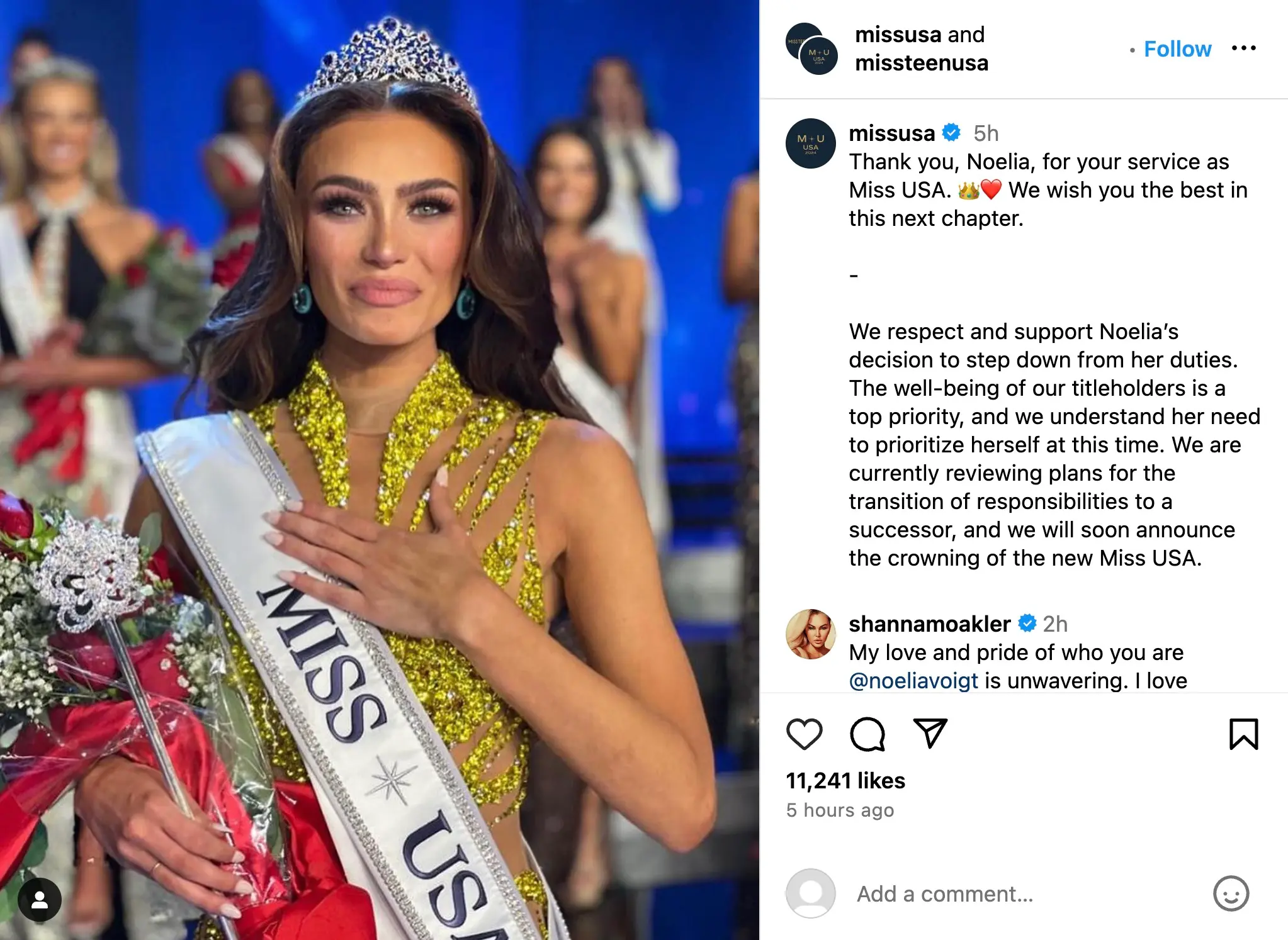 Shocking Revelations Rock Miss USA: Hidden Messages Expose Silent Struggles